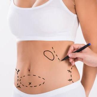Liposuction Procedure In Riyadh